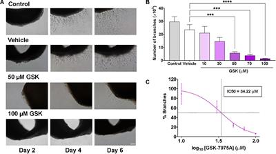 <mark class="highlighted">SARAF</mark> and Orai1 Contribute to Endothelial Cell Activation and Angiogenesis